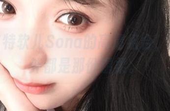 蕾丝与特软儿Sona的高清组合，图里图外都是那份温柔。